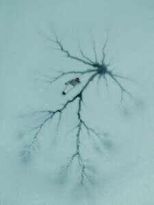 neurometabolismus
